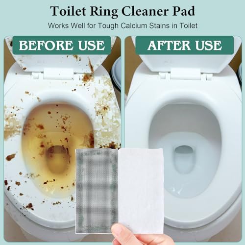 Dingion 6-Piece Toilet Ring Remover Cleaner Pads